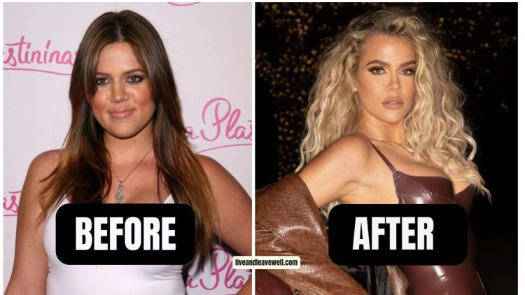 Khloé Kardashian Admits She Feels ‘More Insecure’ After Losing Weight – Here’s Why