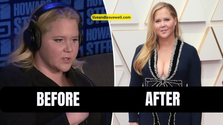 Amy Schumer’s Transformative Health Journey- Embracing Mounjaro For Wellness And Vitality